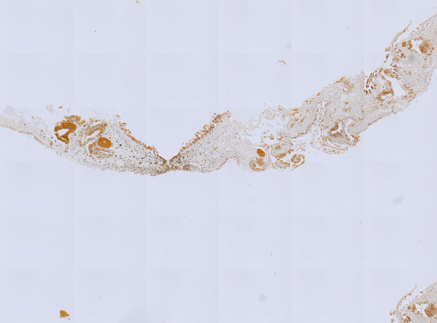 Mikroskopisches Bild einer Formalin/PFA-fixierten Paraffin-embedded Gewebesektion, die mit anti-PFA1-Antikörper (EPR22828) und BSA gefärbt ist.